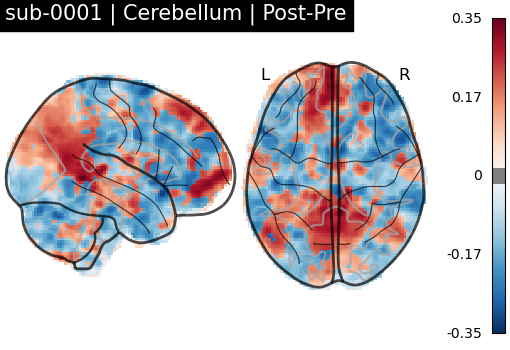 sub-0001_Cerebellum_diff-comparison.png