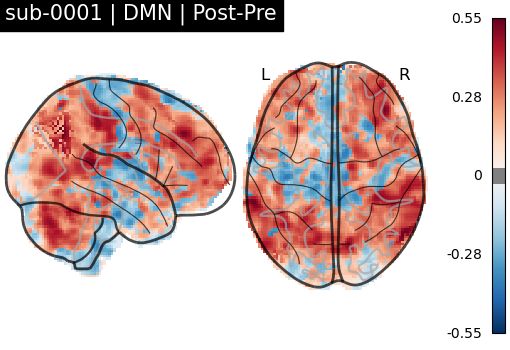 sub-0001_DMN_diff-comparison.png