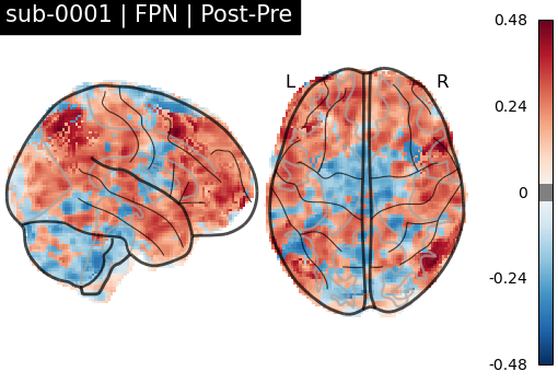 sub-0001_FPN_diff-comparison.png