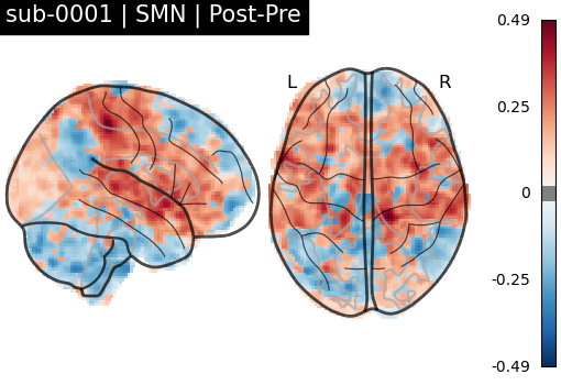 sub-0001_SMN_diff-comparison.png
