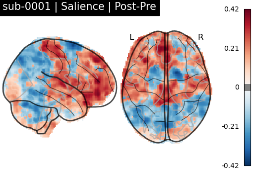 sub-0001_Salience_diff-comparison.png
