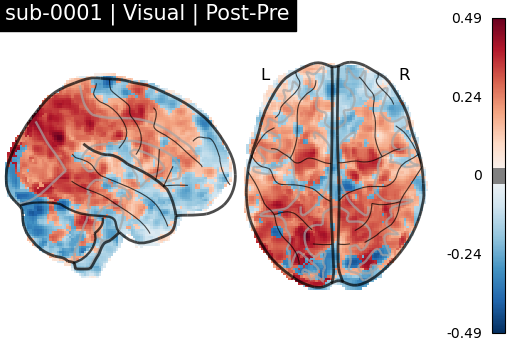 sub-0001_Visual_diff-comparison.png