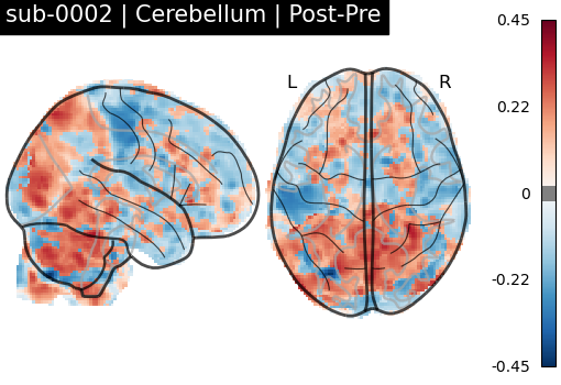 sub-0002_Cerebellum_diff-comparison.png