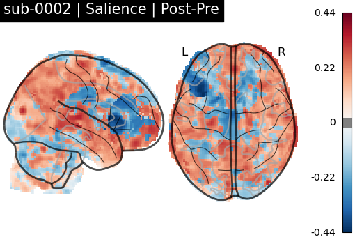 sub-0002_Salience_diff-comparison.png