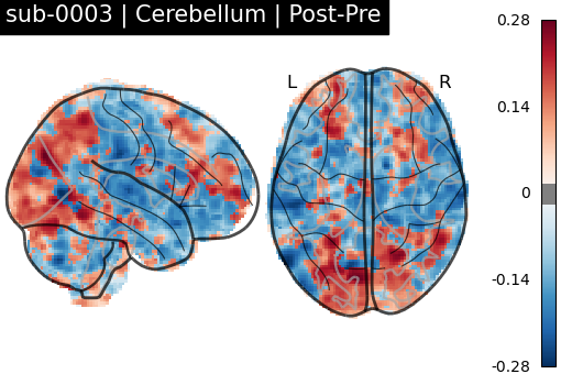 sub-0003_Cerebellum_diff-comparison.png