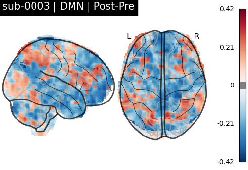 sub-0003_DMN_diff-comparison.png