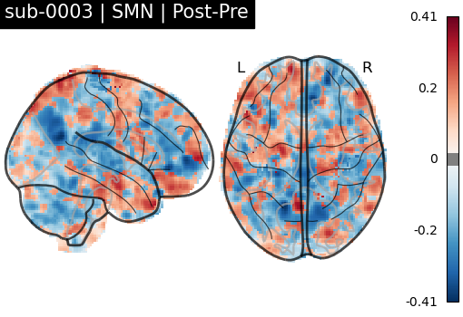 sub-0003_SMN_diff-comparison.png