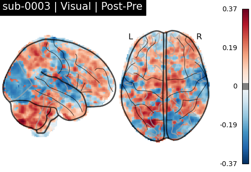 sub-0003_Visual_diff-comparison.png