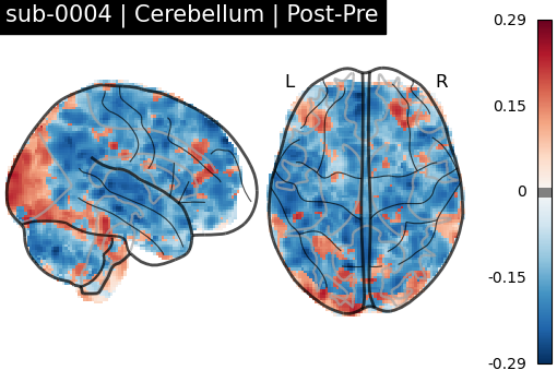 sub-0004_Cerebellum_diff-comparison.png