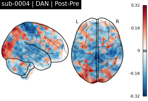 sub-0004_DAN_diff-comparison.png