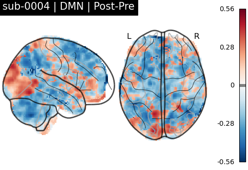 sub-0004_DMN_diff-comparison.png