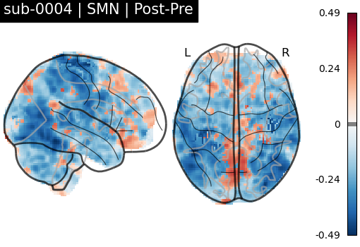 sub-0004_SMN_diff-comparison.png