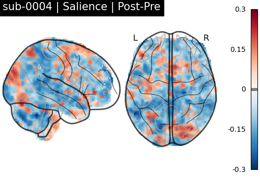 sub-0004_Salience_diff-comparison.png