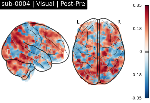 sub-0004_Visual_diff-comparison.png