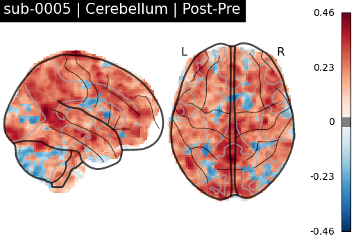 sub-0005_Cerebellum_diff-comparison.png