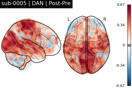 sub-0005_DAN_diff-comparison.png