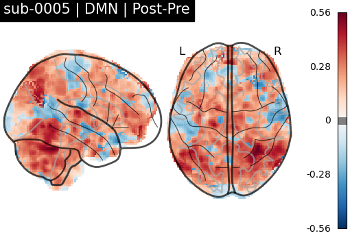 sub-0005_DMN_diff-comparison.png