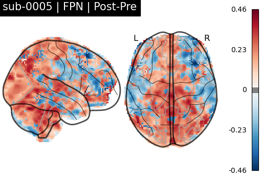 sub-0005_FPN_diff-comparison.png
