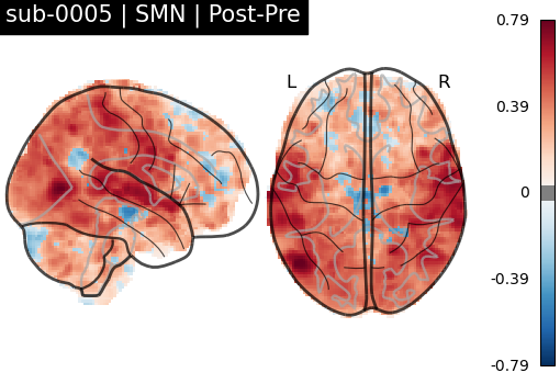 sub-0005_SMN_diff-comparison.png