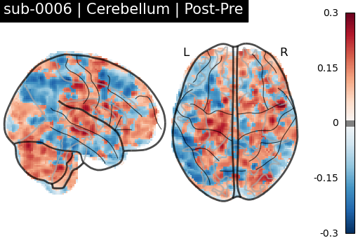 sub-0006_Cerebellum_diff-comparison.png