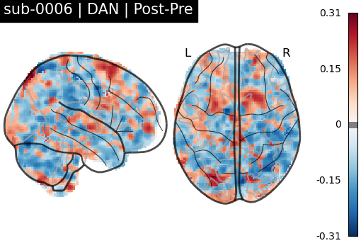 sub-0006_DAN_diff-comparison.png