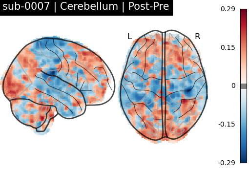 sub-0007_Cerebellum_diff-comparison.png