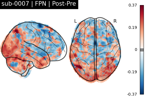 sub-0007_FPN_diff-comparison.png