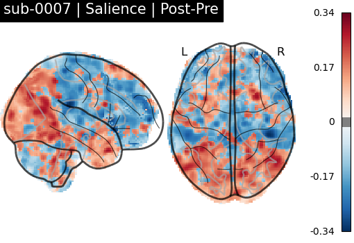 sub-0007_Salience_diff-comparison.png