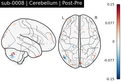 sub-0008_Cerebellum_diff-comparison.png