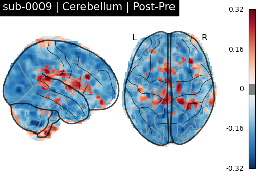 sub-0009_Cerebellum_diff-comparison.png