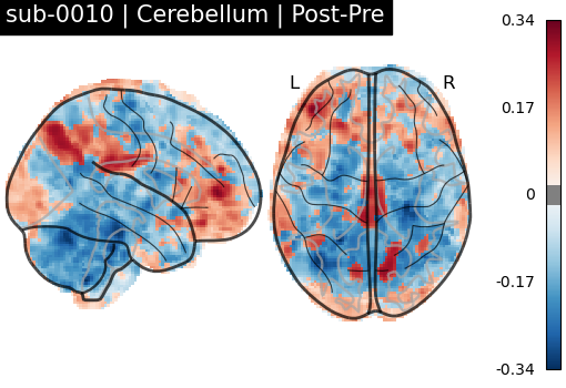 sub-0010_Cerebellum_diff-comparison.png