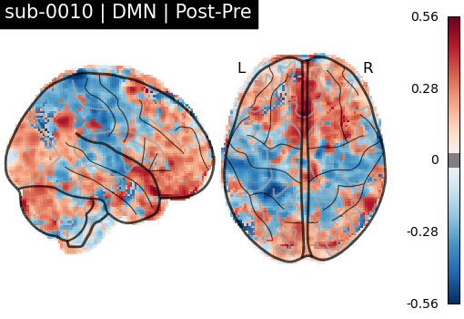 sub-0010_DMN_diff-comparison.png
