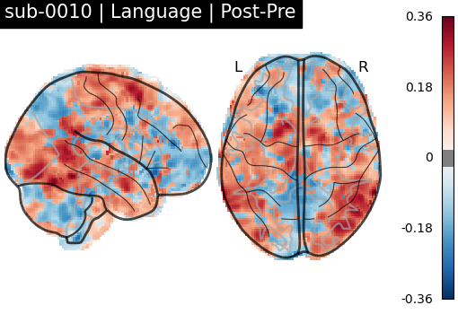 sub-0010_Language_diff-comparison.png