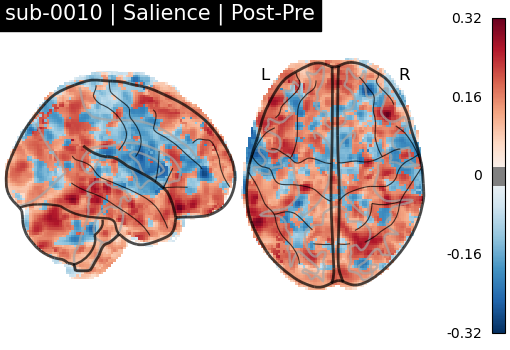 sub-0010_Salience_diff-comparison.png