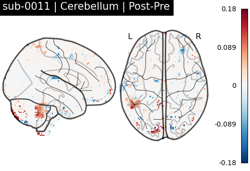 sub-0011_Cerebellum_diff-comparison.png