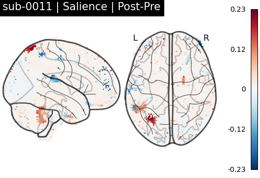 sub-0011_Salience_diff-comparison.png