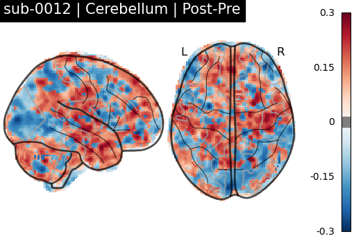 sub-0012_Cerebellum_diff-comparison.png