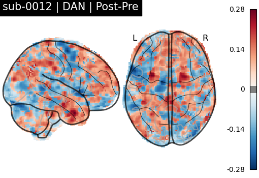 sub-0012_DAN_diff-comparison.png