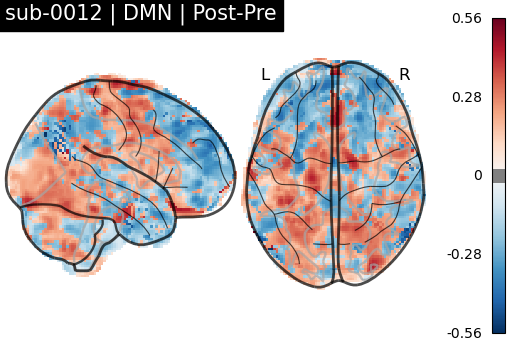 sub-0012_DMN_diff-comparison.png