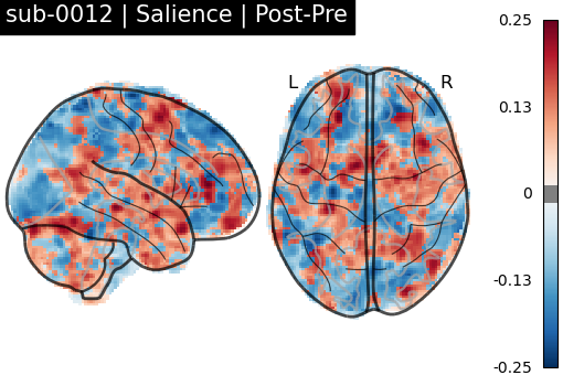 sub-0012_Salience_diff-comparison.png