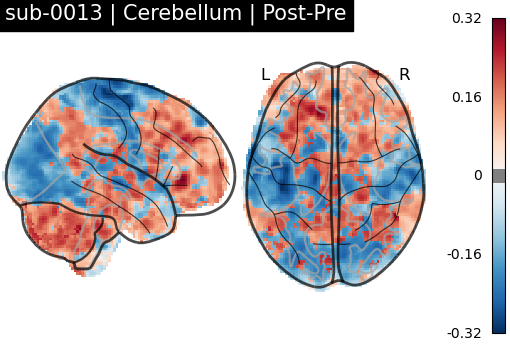 sub-0013_Cerebellum_diff-comparison.png