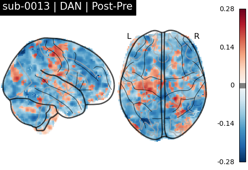 sub-0013_DAN_diff-comparison.png
