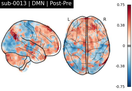 sub-0013_DMN_diff-comparison.png