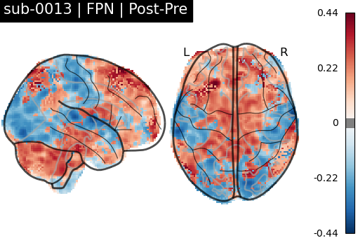 sub-0013_FPN_diff-comparison.png