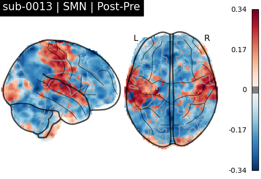sub-0013_SMN_diff-comparison.png