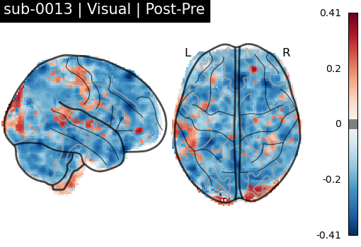 sub-0013_Visual_diff-comparison.png