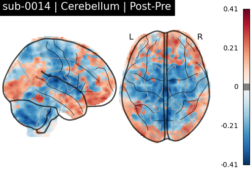 sub-0014_Cerebellum_diff-comparison.png