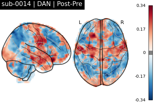sub-0014_DAN_diff-comparison.png