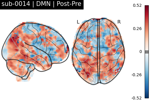 sub-0014_DMN_diff-comparison.png