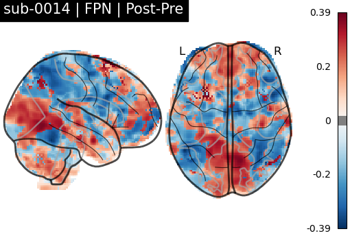 sub-0014_FPN_diff-comparison.png